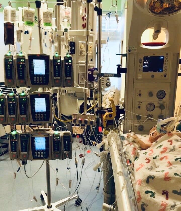 Claire Fox in the PICU as an infant. Image description: An infant rests in a hospital bed, covered by a blanket with a baby footprint pattern. She is intubated, and dozens of medical lines and tubes run from her body to several machines, including a…