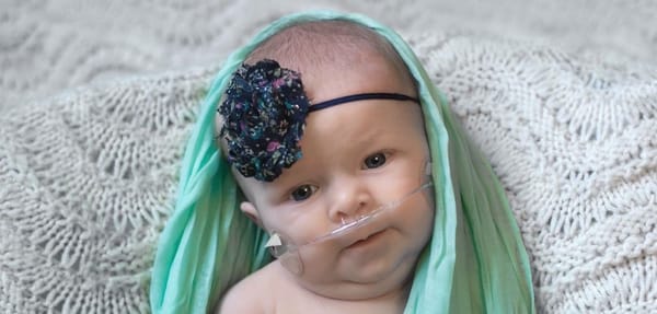 A baby wearing an oxygen cannula, a floral headband, and a soft green scarf.
